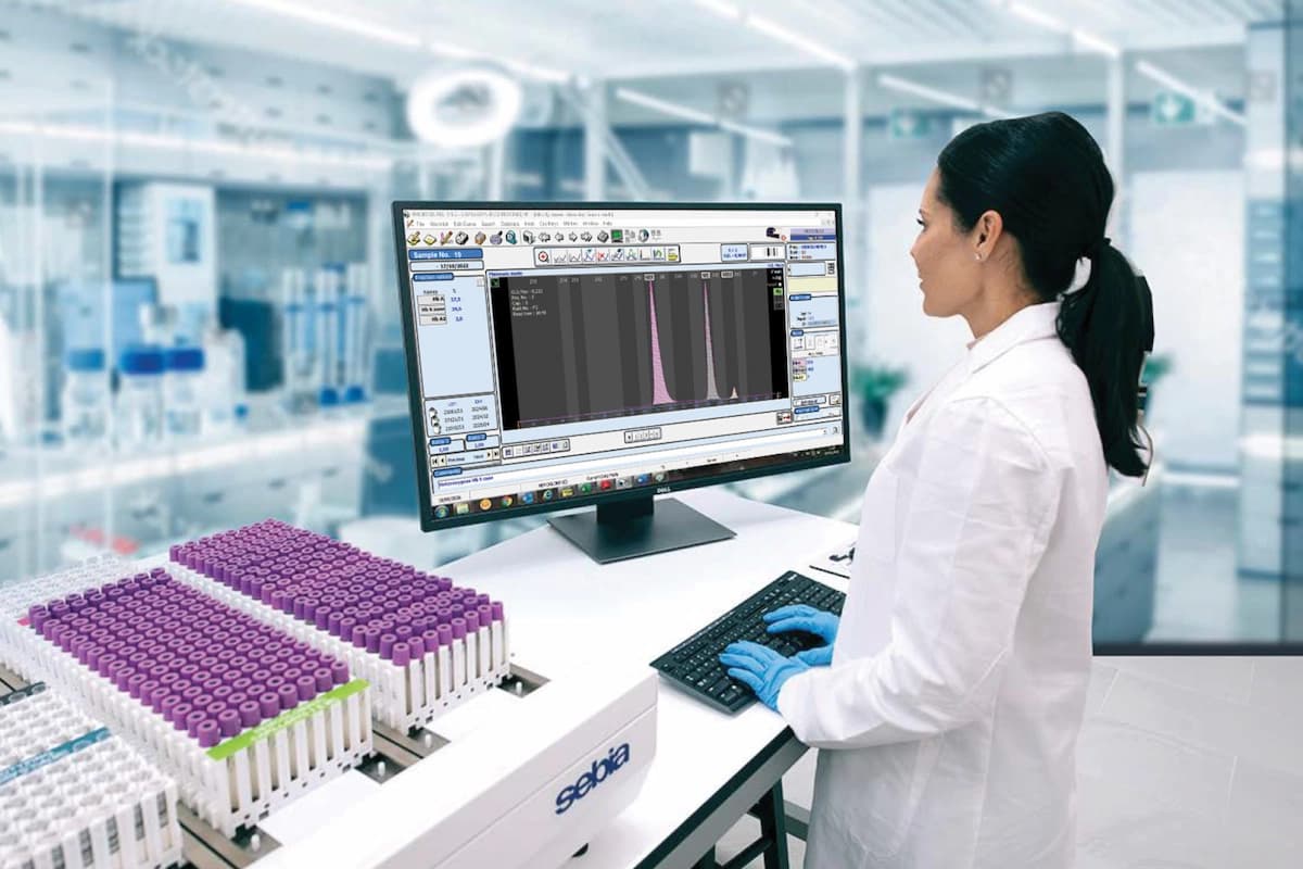 Woman in a lab in front of a CAPILLARYS 3 TERA MC instrument and a monitor with a Hb disorder profile