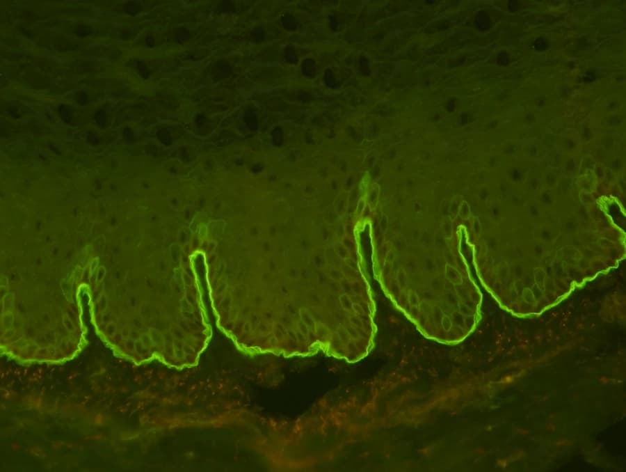 Sebia Basement Membrane pattern