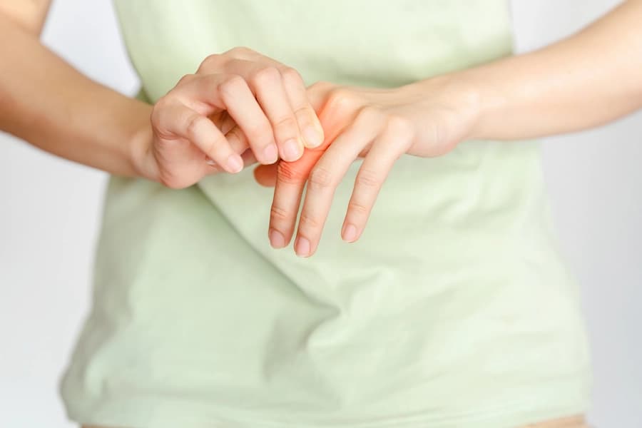 Rheumatoid Arthritis