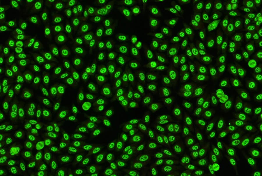 Nuclear Patterns, AC-5 with cells