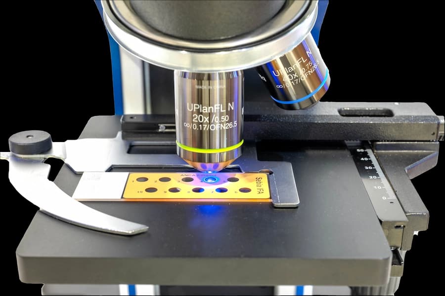 View of a dIFine® M1 manual microscope's slides using IFA techology